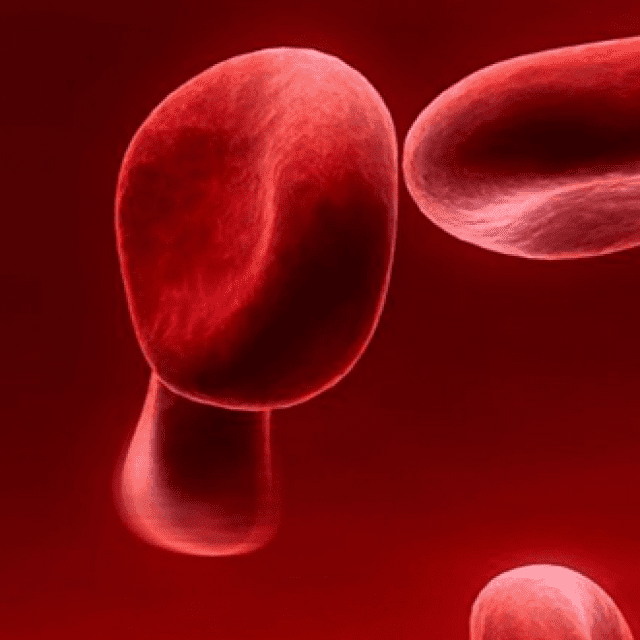 Platelet Rich Fibrin PRF