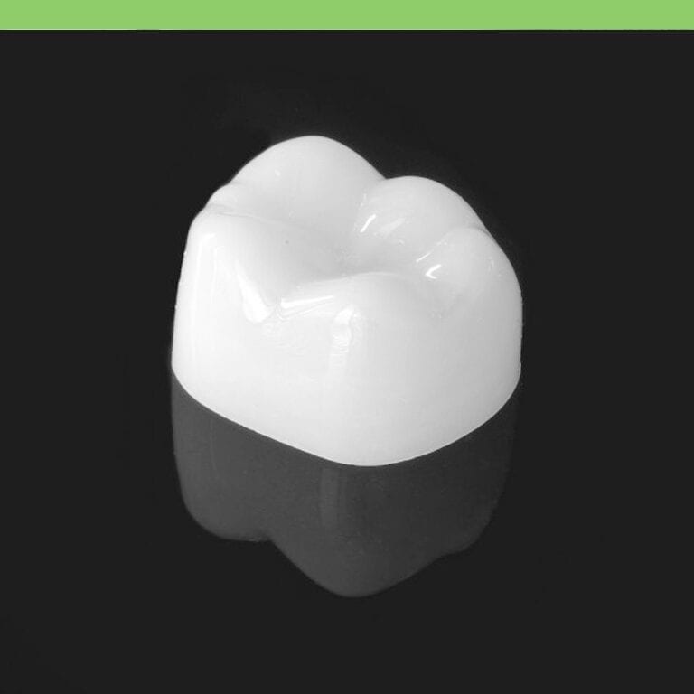 Composite Crowns Costa Rica Dental Guide to Best Dentists